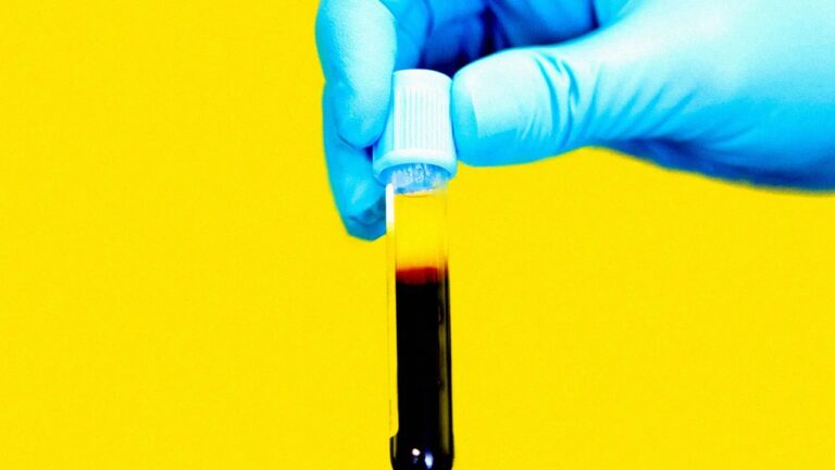 Spike Transfusion anyone?
