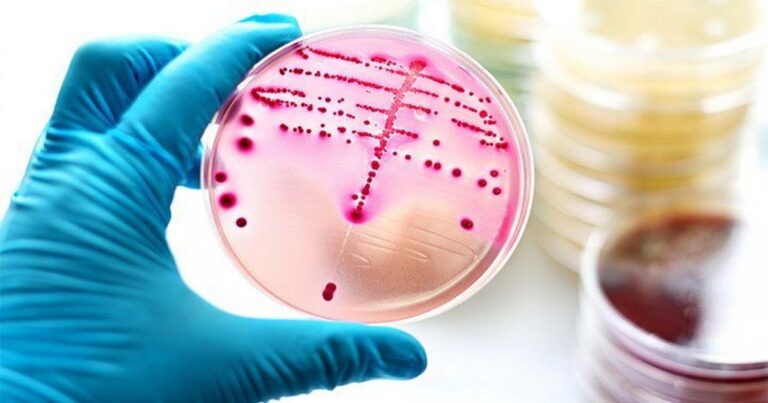 Perspectives on Strep A!