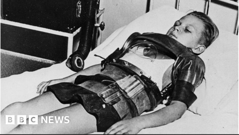 Polio was a scam…!